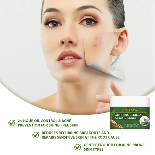 Crema Para El Acné Para Piel Sensible Y Grasa 50g