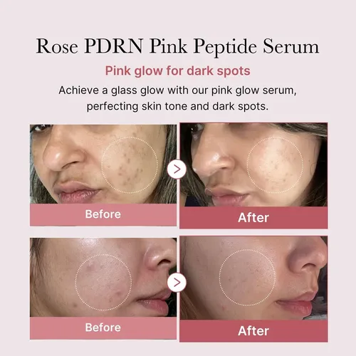 Special Offer T; Crema Hidratante Y Humectante Rose Pdrn ..