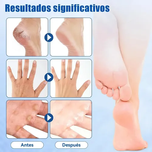 Exfoliante De Pies Hidratante Para Callos Y Durezas