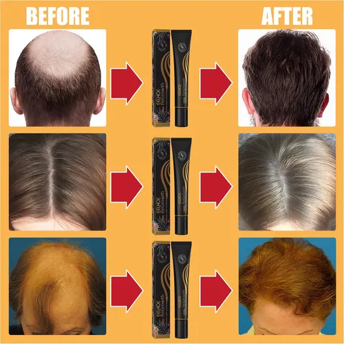 Eelhoe Cuidado Del Cabello Líquido Bola Diseño De Masaje