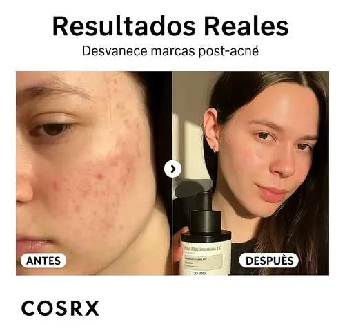 Cc Sérum Para Controle De Oleosidade Facial Cosrx The Cv