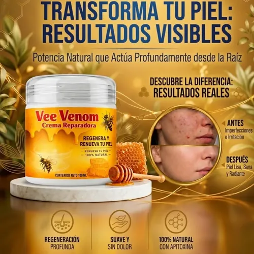 Crema Vee Venom Para Verrugas Natural 100ml Cuidado Piel