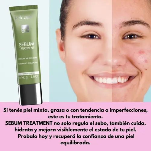 Crema Antiacne Sebum Idraet Tratamiento Gel Piel Grasa 45 G