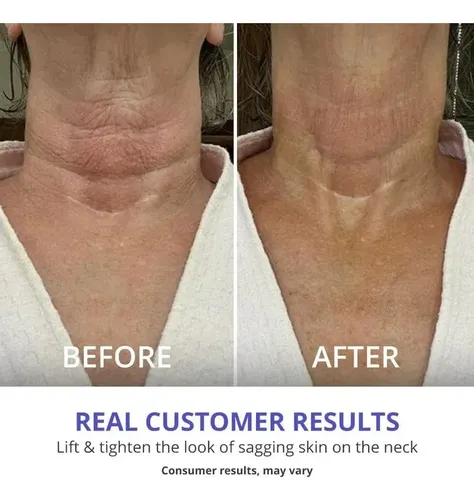 Crema Levanta Cuello Reafirmante 2×1 Oferta Día De La Madre