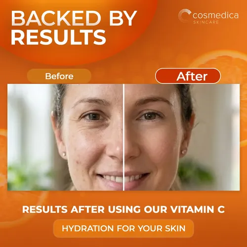 Sérum Cosmedica De Vitamina C Para Rostro Con Ácido Hialurón Todo Tipo De Piel Día/noche