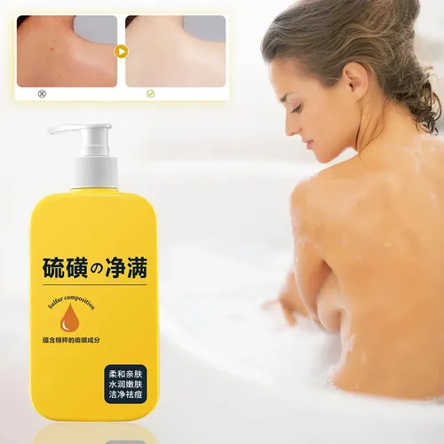 Gel Limpiador Y Eliminador Suave Que Puede Causar Cada Baño