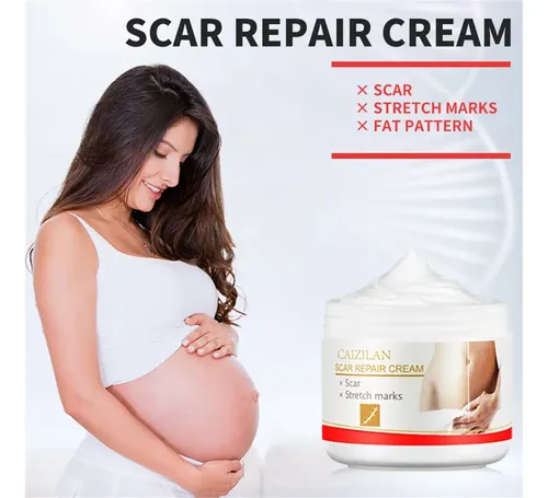 Crema Para Eliminar Cicatrices Y Estrías Scar Striae Gravi