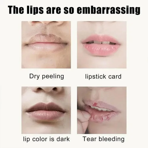 Aclarador Labial For Labios Oscuros Aclarador Labial