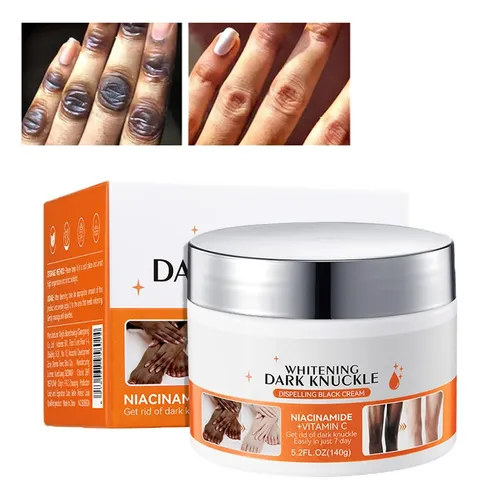 5.2oz Large Dark Knuckle Whitening Cream,skin Bleaching For