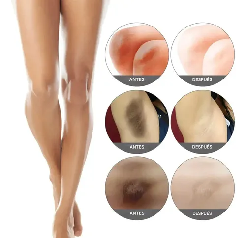 Crema Blanqueadora, Crema Iluminadora, Para Axilas, Rodillas, Codos, Muslos Internos, Línea Del Bikini, Crema.