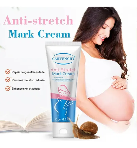 Jh Ah Crema De Estrías For Mujer, Crema Hidratante Corporal