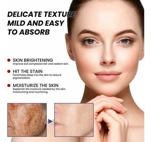 Crema Facial Hidratante For Manchas De Pigmento Aclarante