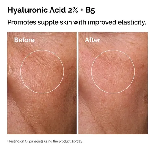 The Ordinary Sérum Niacinamida Ácido Hialurónico 2x30ml Rostro