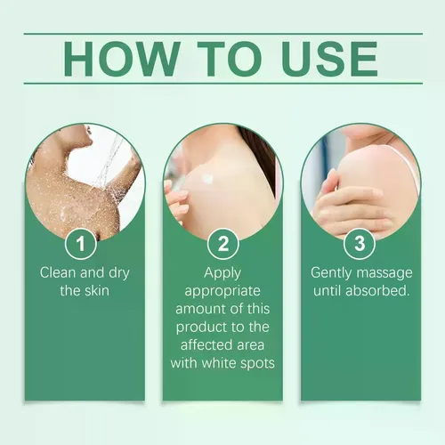 La Crema New Z Para El Vitíligo Reduce Las Manchas Blancas.