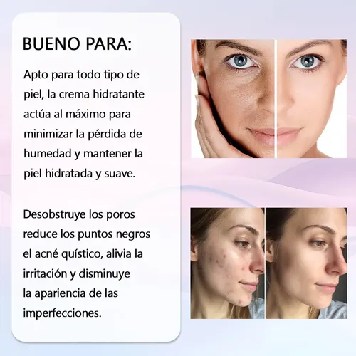 Facial Crema Hidratante 100g + Acné Loción Secante 29ml