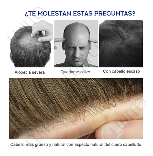 Prótesis Capilar Indetectable Cabello Humano