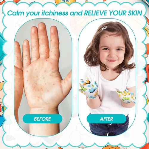 Guantes Algodón Hidratantes Para Eczema Niños 7 8 Años