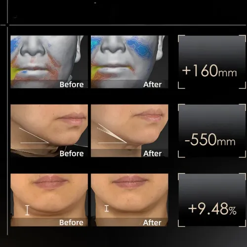 Crema Winona Silver Core, Antiarrugas Y Reafirmante Todo Tipo De Piel