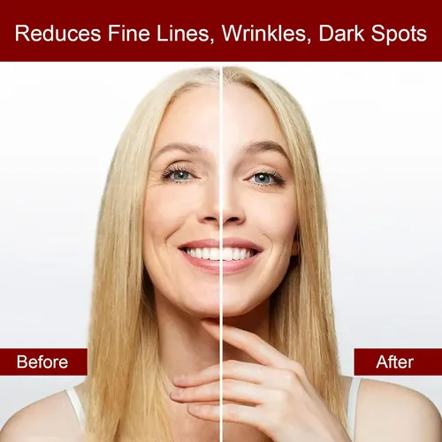 Crema Facial Antiedad Y Reafirmante Con Veneno De Abeja Y Cú