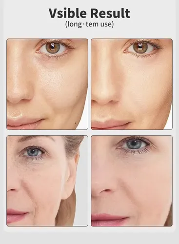 Terapia De Refuerzo Lefacial Colors Eye Pro Light 7