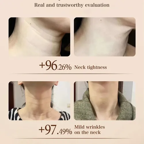 La Crema Reafirmante Y Reafirmante Para Cuello Enrollado Pro