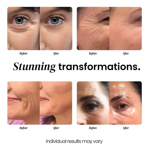 Eliré Crema Facial Antiage Con Vitamina C Niacinamida Y Aloe Momento De Aplicación Día/noche Tipo De Piel Todo Tipo De Piel
