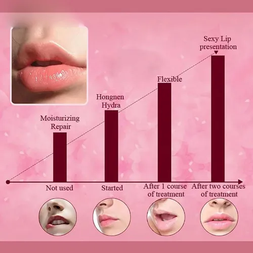 Mascarilla Labial, 30 Unidades De Almohadillas De Gel Para E
