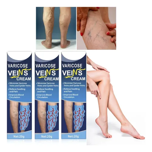 Pomada Varices Estrias Circulatoria Piernas Nutricion X3