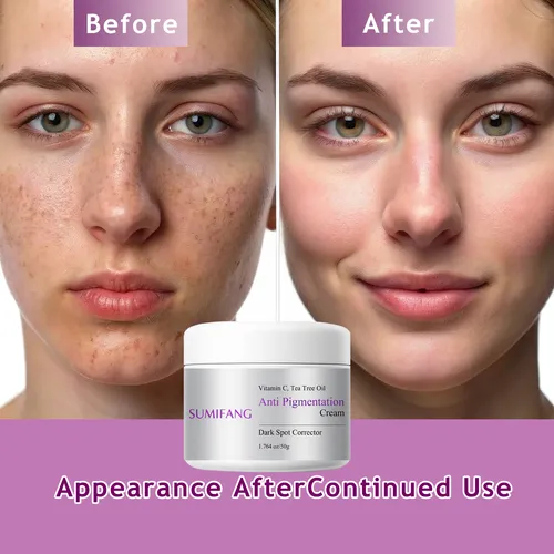 Crema Para Manchas Oscuras Y Piel Opaca 50g