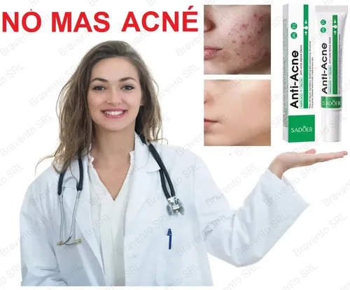 Crema Tratamiento Acne Granitos 100% Efectividad Todo Tipo De Piel Día/noche