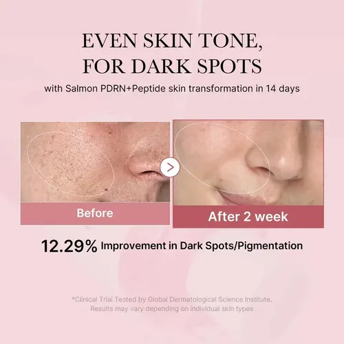 Tónico Facial Pdrn Hidratante Iluminador 150 Ml