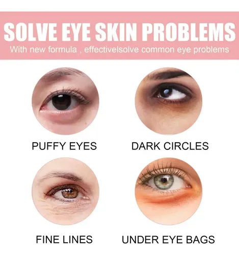 S-mz724 Parches Para Ojos, Ojeras Y Decoloración, 60