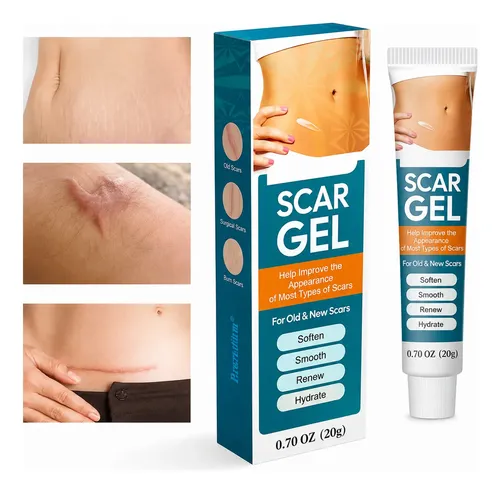 Crema Gel Reparadora Cicatrices Queloide Acne Quemadura Scar