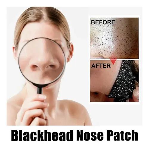 Blackhead Remover Spots Mask Acne Treatment Nose  Ii No