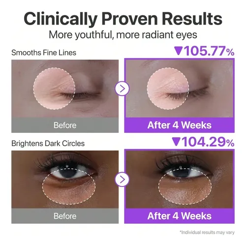 Crema Para Ojos Nad+retinol, Puede Reducir Las Líneas Finas  Todo Tipo De Piel Día/noche