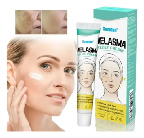 Crema Quita Melasma Manchas Por Edad Y Sol