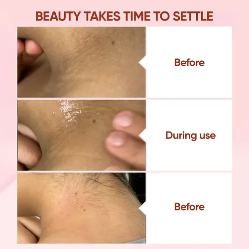 Gel Exfoliante, Elimina La Piel Muerta, Suaviza Y Tierna, 50 Ml Neutra