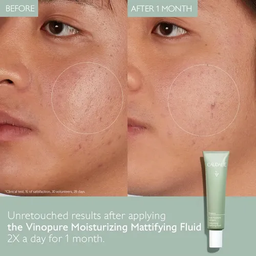 Crema Hidratante, Hidratante Y Matti Caudalie Vinopure Oil C