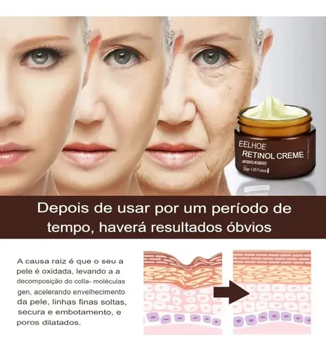 Crema Antiedad, Antiarrugas Y Corporal 3pure Retinol Al 2,5%
