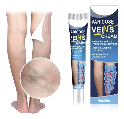Crema Piernas Hinchazon Estrias Frescura Prolongada X3