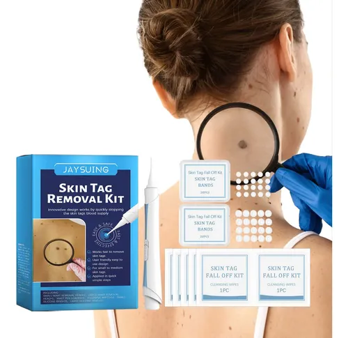 Skin Mole Remover Ii, Kit 2 En 1, Etiqueta Para Eliminar Man