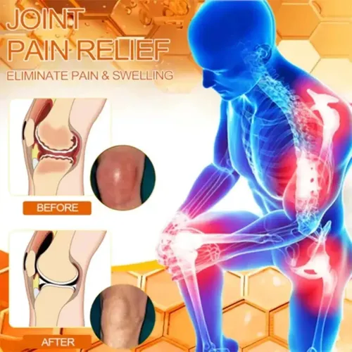 Pomada Milagrosa Para El Dolor Y Las Lesiones De Rodilla Aho
