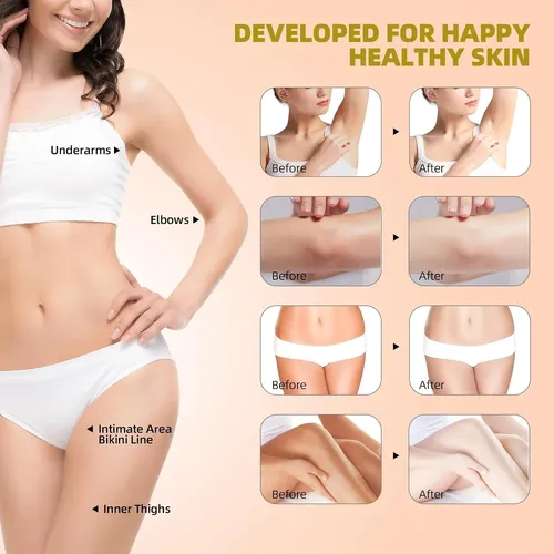 Crema Blanqueadora De Piel Para Eliminar Manchas Oscuras Del
