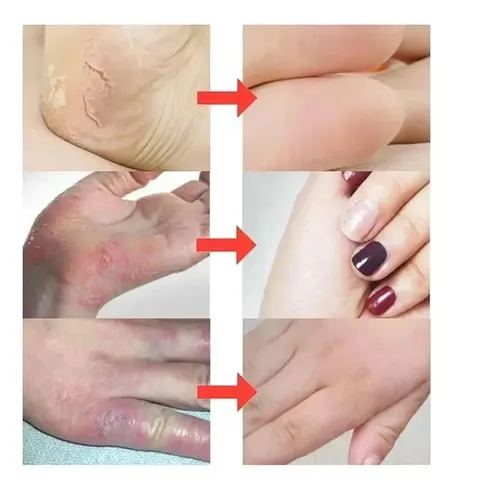 O Crema De Manos Antiarrugas Nutritiva
