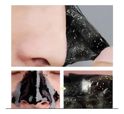 Parche X10 Puntos Negros Nariz Rostro Mascarilla Limpieza Tipo de piel Normal a grasa