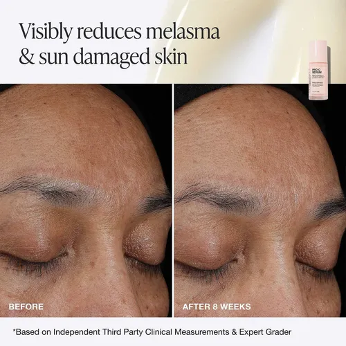 Innbeauty Project C Serum Facial 15% Vitamina C + Ácido Ferú