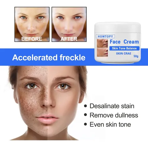 Crema Iluminadora Única Para Manchas Faciales, 50 G, Melasma