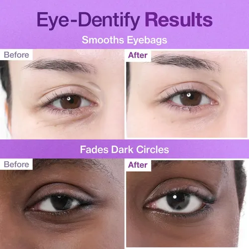 Parche Para Ojos Numbuzin No.9 Nad+ Colágeno Para Ojeras