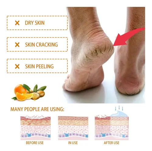 Hy/ Crema Nutritiva Para Manos Y Pies Hoygi Para Piel Seca
