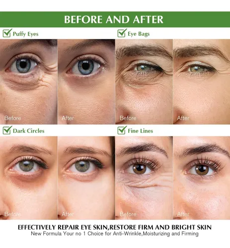 Parches Ojos Té Verde Enaskin Naturals 30 Pares